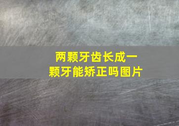 两颗牙齿长成一颗牙能矫正吗图片