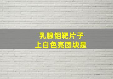 乳腺钼靶片子上白色亮团块是