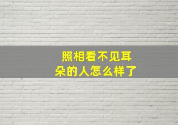 照相看不见耳朵的人怎么样了