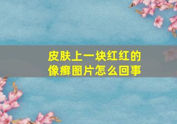 皮肤上一块红红的像癣图片怎么回事