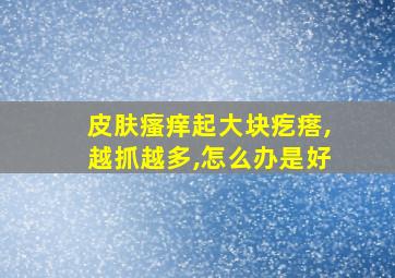 皮肤瘙痒起大块疙瘩,越抓越多,怎么办是好