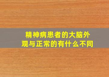 精神病患者的大脑外观与正常的有什么不同