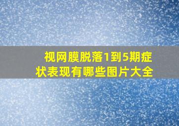 视网膜脱落1到5期症状表现有哪些图片大全