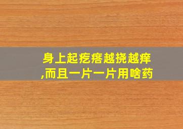 身上起疙瘩越挠越痒,而且一片一片用啥药