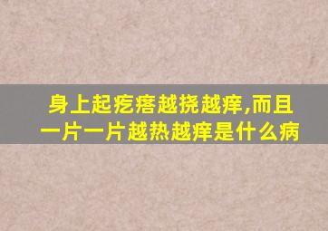 身上起疙瘩越挠越痒,而且一片一片越热越痒是什么病