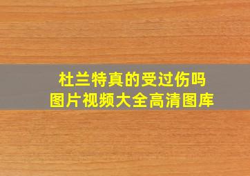 杜兰特真的受过伤吗图片视频大全高清图库