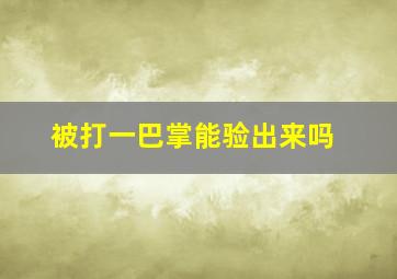 被打一巴掌能验出来吗