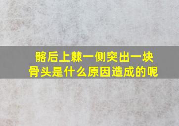 髂后上棘一侧突出一块骨头是什么原因造成的呢