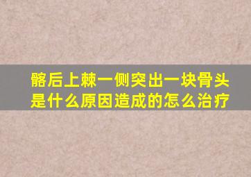 髂后上棘一侧突出一块骨头是什么原因造成的怎么治疗