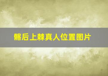 髂后上棘真人位置图片