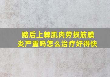 髂后上棘肌肉劳损筋膜炎严重吗怎么治疗好得快