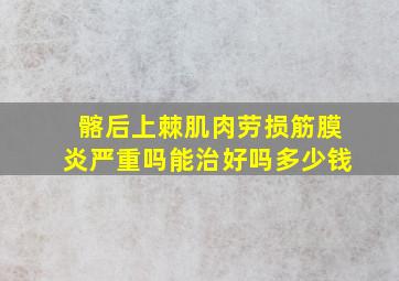 髂后上棘肌肉劳损筋膜炎严重吗能治好吗多少钱